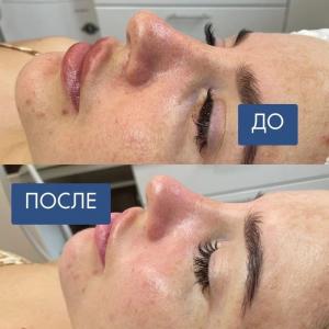 Фотография Geometry 4