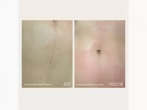 Фотография 28 Дней 2
