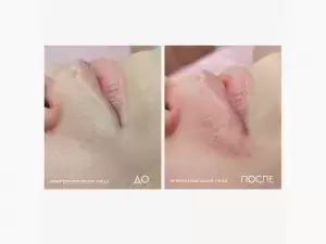 Фотография 28 Дней 0